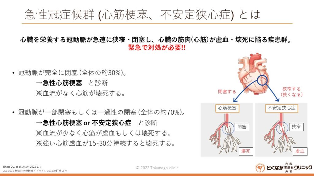 心筋梗塞 のイメージ画像